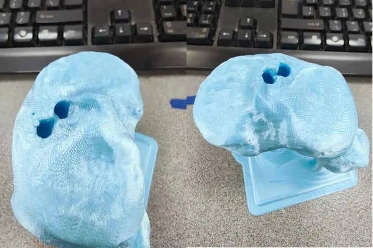 長沙市中醫院應用3D打印技術制作百余例模型，助力精準醫療